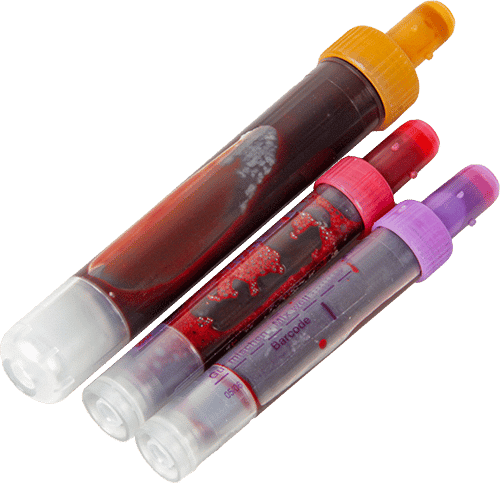 Blood Sample