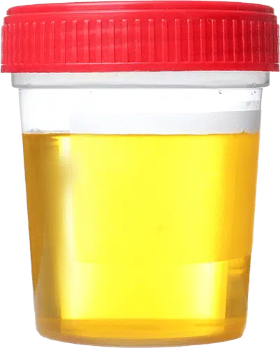 Urine Sample Urine Sample